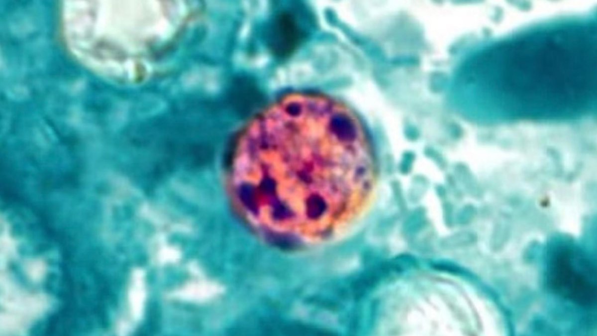 related